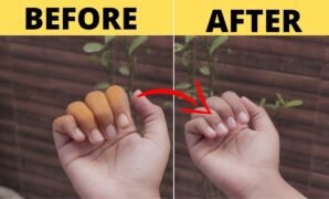 Kitchen Hacks: Effortless and Natural Methods to Eradicate Stubborn Turmeric Stains from Hands and Nails